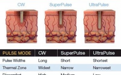 Breve Estudio de Clinica Dermatologica de Tel-Aviv  (Israel)  sobre el Tratamiento de la Onicomicosis con IPL