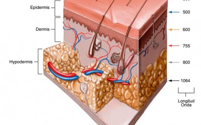 LOS FILTROS  EN LAS IPL Y Nd:Yag (Breve pero Sencilla Explicación)