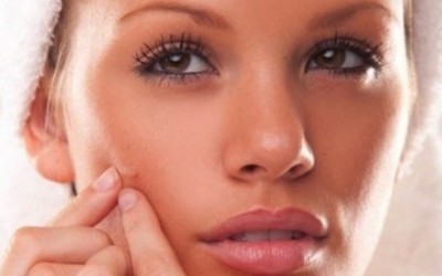 Ocho soluciones caseras para el Acne