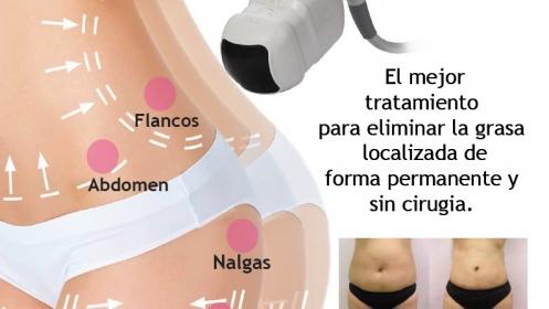 https://www.formaciononlinenutridermo.com/curso/libro-hifu-manual-ultrasonidos-focusados-de-alta-intensidad-facial-corporal-tapa-blanda-9-marzo-2019/