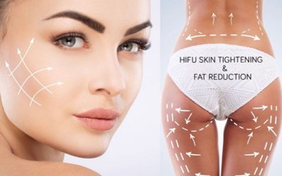 NDV 4D UFFs Ultrasonido Focusado, Tratamientos HIFU para rejuvenecer nuestra cara y cuerpo