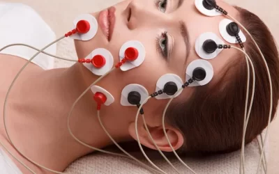 Bioestimulación muscular facial. Lifting facial no quirúrgico