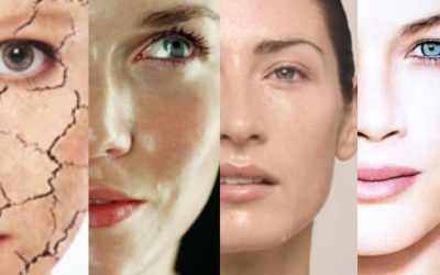 Pasos para realizar un análisis facial (Estado de la Piel). Metodología