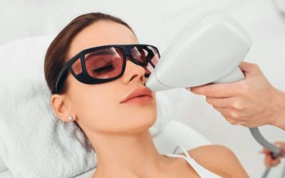 La depilación láser facial: Una solución eficaz y duradera para reducir el vello no deseado