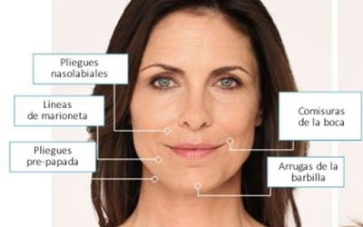 Diferencias entre Líneas de Marioneta y Pliegues Nasolabiales y su Tratamiento con Plasma Frío y Radiofrecuencia